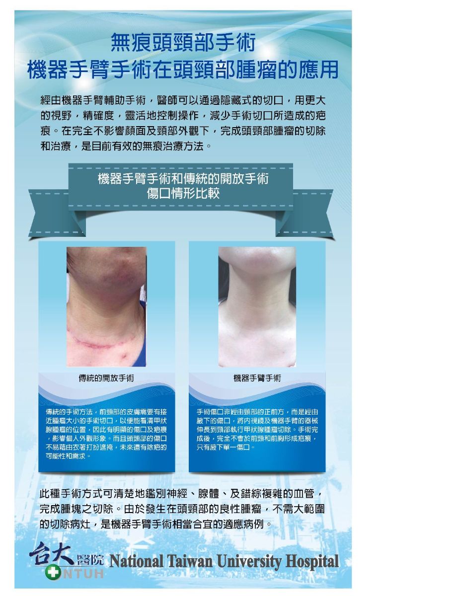 機器手臂手術在頭頸部腫瘤的應用