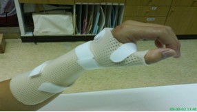 肌腱滑膜炎患者使用之長型對掌副木