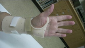 腕隧道症候群患者使用之豎腕副木