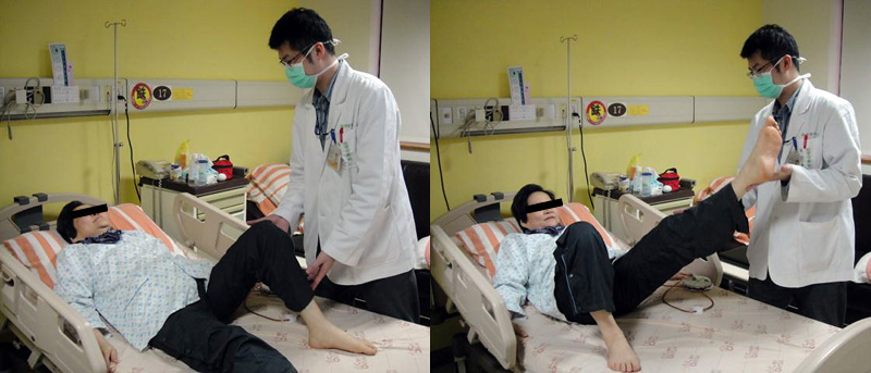 Post-operative physical therapy