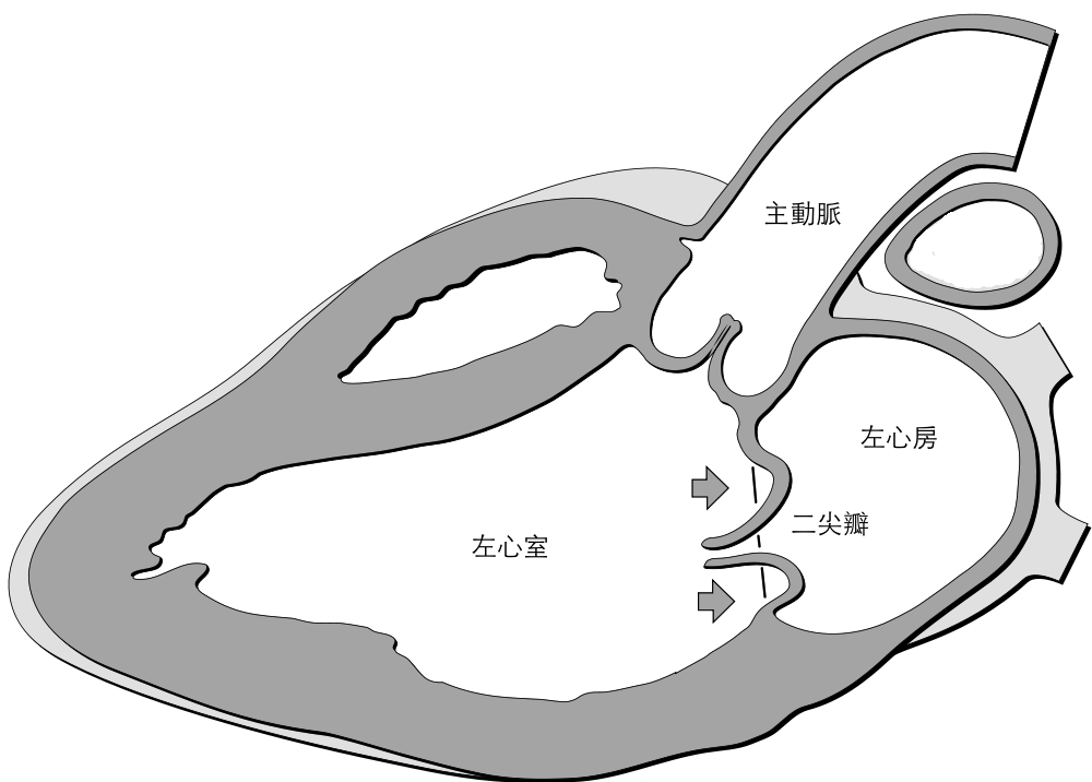 左心房及左心室的假設界線