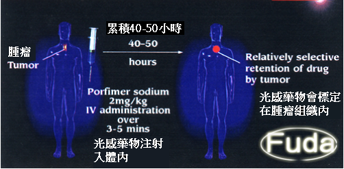 第二階段治療