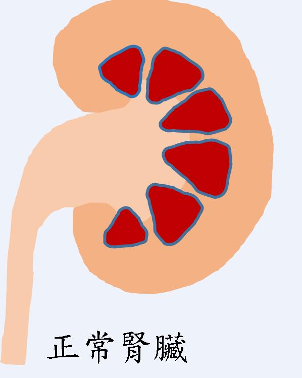 正常腎臟