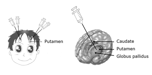 Method of gene delivery