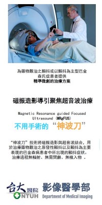 不用手術的'神波刀'治療顫抖