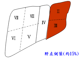 肝左側葉
