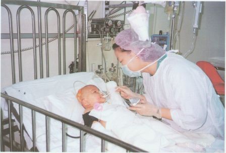 1994年燒傷加護病房護理人員餵食病孩布丁