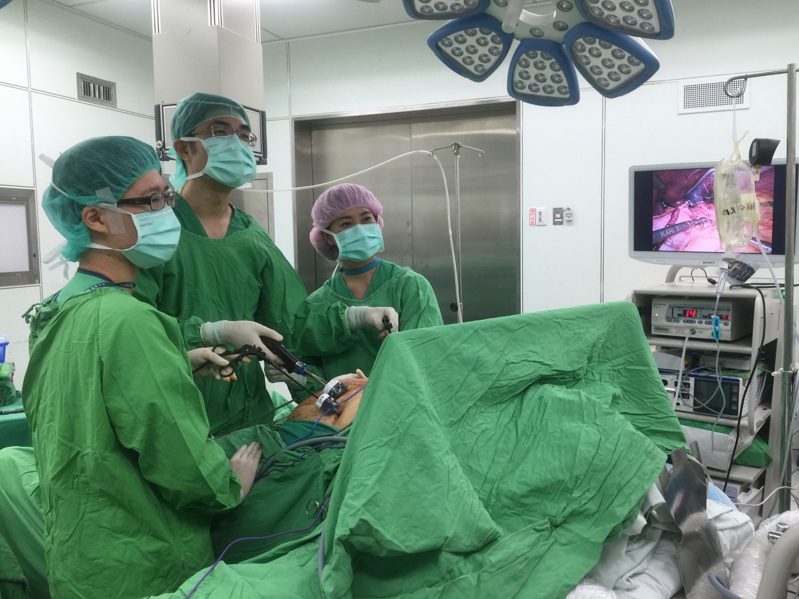 腹腔鏡手術圖