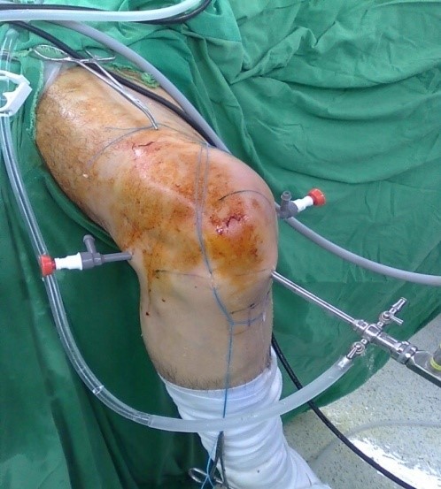 運動醫學科 特色醫療_2